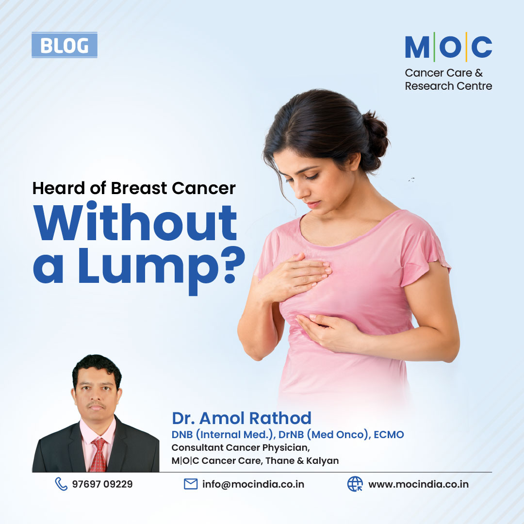 Breast Cancer Without a Lump: Symptoms & Warning Signs